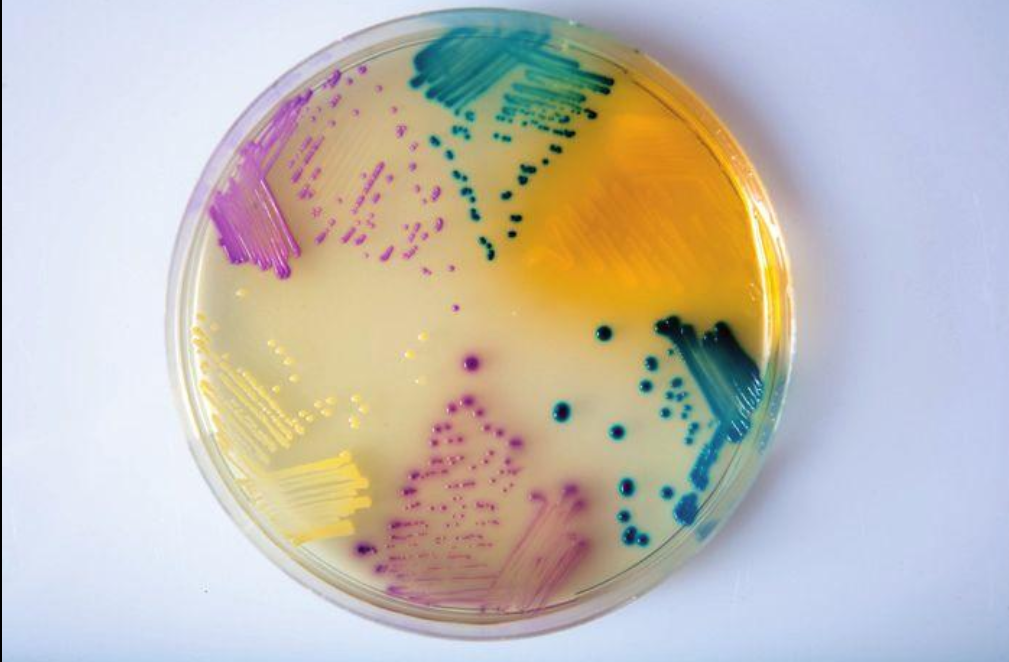 Colorful microbiology agar plate
