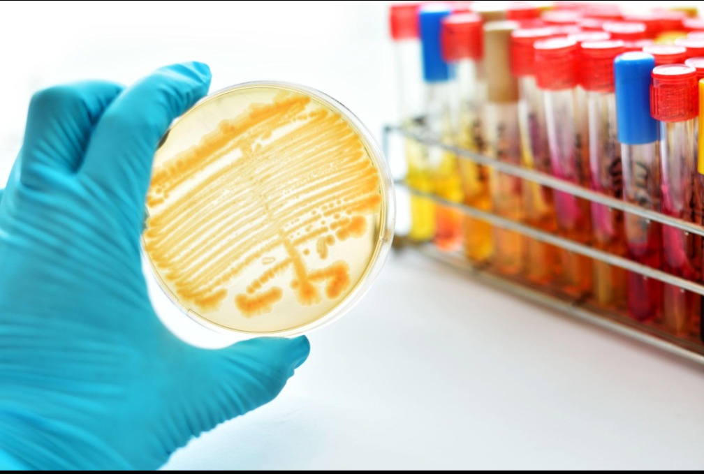 Scientist holding bacterial culture plate